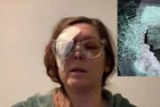 加州東灣護士高速公路開車，被故意扔石子，或致右眼失明