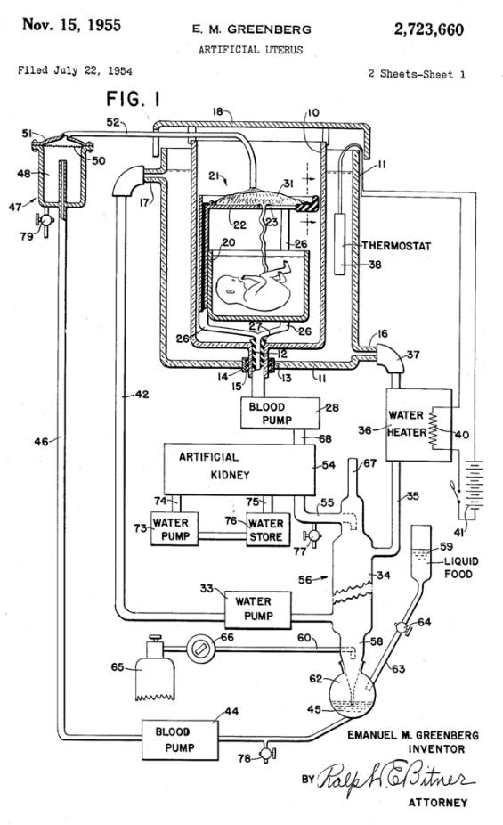 圖2. 1955年的人工子宮模型專利
