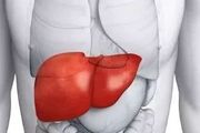 脂肪肝是什麼導致的？