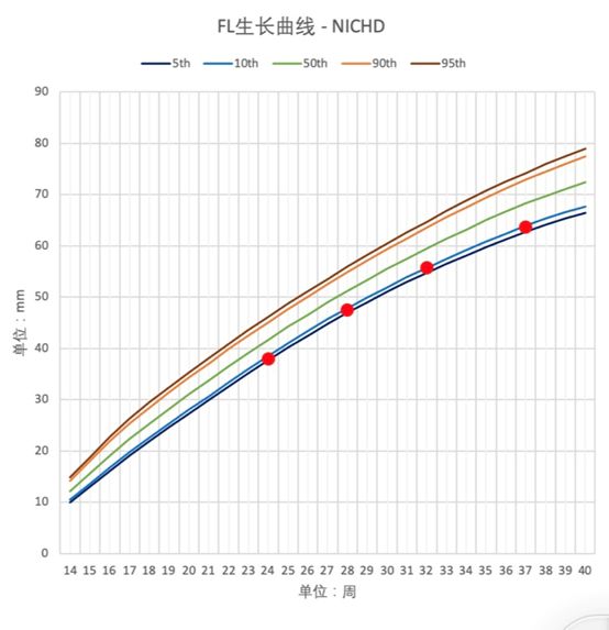 产检超声波发现胎儿的腿短 这是什么情况 Vito杂志